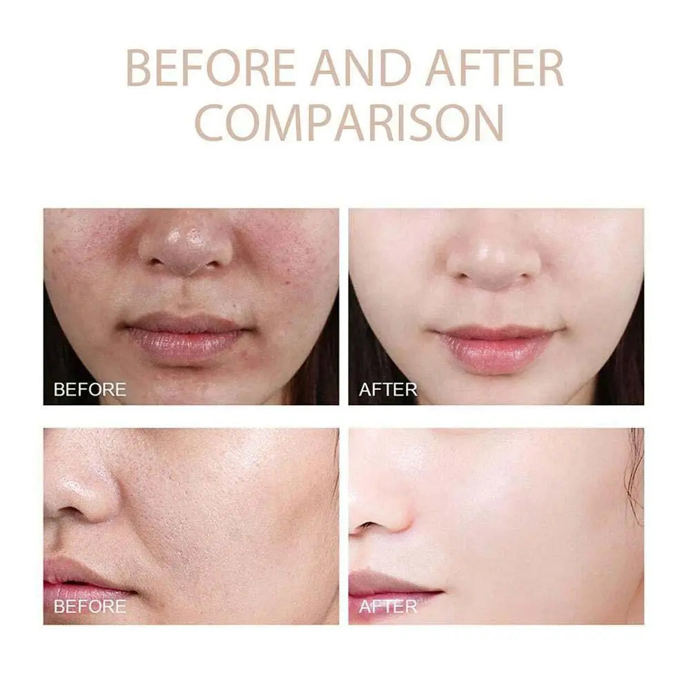 Dr. Melaxin Rice Exfoliating Serum - Hydrating Facial Moisturizer for Blackhead Removal and Pore Minimization in Korean Skincare